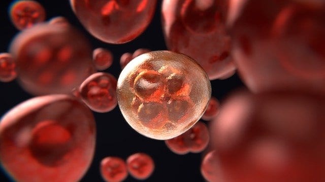 Colon cancer can be deadly — but is largely preventable